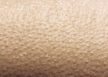 Goosebumps
