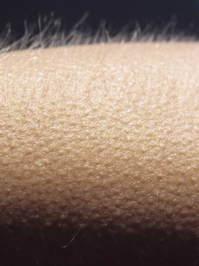 गूसबम्प्स( goosebumps) आने के 7 प्रमुख कारण