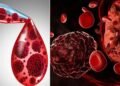 Blood Cancer Day