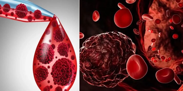 Blood Cancer Day