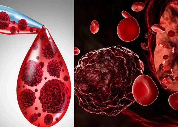 Blood Cancer Day