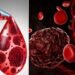 Blood Cancer Day