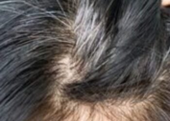 white hair