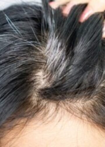 white hair