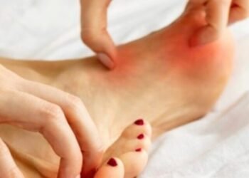 Fungel Feet