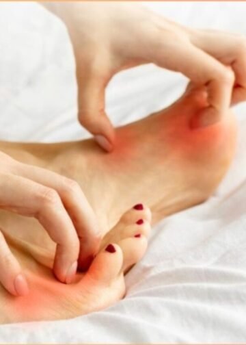 Fungel Feet