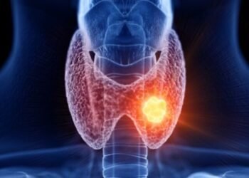Thyroid Cancer